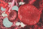 Surgeons commonly off the mark in estimating blood loss